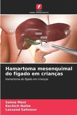 Salma Mani, Kechich Nahla, Lassaad Sahnoun - Hamartoma mesenquimal do fígado em crianças, Häftad. Tillgänglighet: Lägg i varukorg