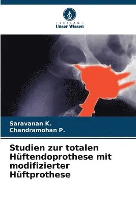 Saravanan K, Chandramohan P - Studien zur totalen Hüftendoprothese mit modifizierter Hüftprothese, Häftad. Tillgänglighet: Lägg i varukorg
