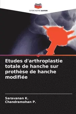 Saravanan K, Chandramohan P - Etudes d'arthroplastie totale de hanche sur prothèse de hanche modifiée, Häftad. Tillgänglighet: Lägg i varukorg
