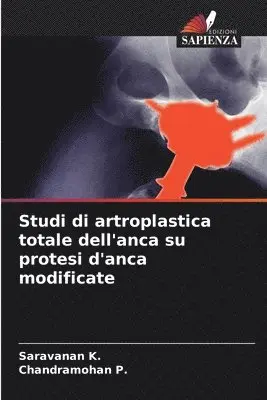 Saravanan K, Chandramohan P - Studi di artroplastica totale dell'anca su protesi d'anca modificate, Häftad. Tillgänglighet: Lägg i varukorg