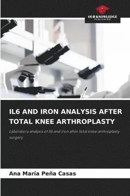 Ana María Peña Casas - Il6 and Iron Analysis After Total Knee Arthroplasty, Häftad. Tillgänglighet: Lägg i varukorg