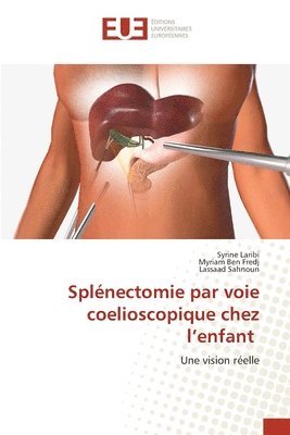 Syrine Laribi, Myriam Ben Fredj, Lassaad Sahnoun - Splénectomie par voie coelioscopique chez l'enfant, Häftad. Tillgänglighet: Lägg i varukorg