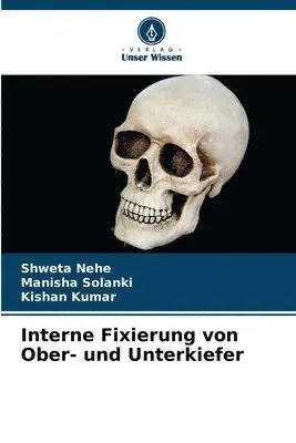 Shweta Nehe, Manisha Solanki, Kishan Kumar - Interne Fixierung von Ober- und Unterkiefer, Häftad. Tillgänglighet: Lägg i varukorg