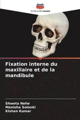 Shweta Nehe, Manisha Solanki, Kishan Kumar - Fixation interne du maxillaire et de la mandibule, Häftad. Tillgänglighet: Lägg i varukorg