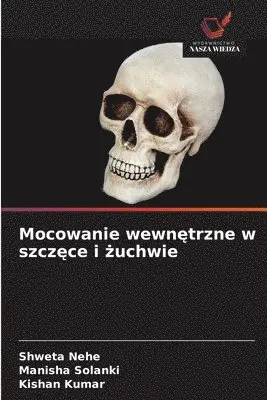 Shweta Nehe, Manisha Solanki, Kishan Kumar - Mocowanie wewnętrzne w szczęce i żuchwie, Häftad. Tillgänglighet: Lägg i varukorg