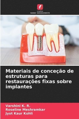 Varshini K R, Roseline Meshramkar, Jyot Kaur Kohli - Materiais de conceção de estruturas para restaurações fixas sobre implantes, Häftad. Tillgänglighet: Lägg i varukorg