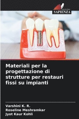 Varshini K R, Roseline Meshramkar, Jyot Kaur Kohli - Materiali per la progettazione di strutture per restauri fissi su impianti, Häftad. Tillgänglighet: Lägg i varukorg