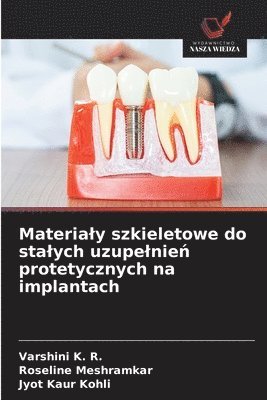 Varshini K R, Roseline Meshramkar, Jyot Kaur Kohli - Materialy szkieletowe do stalych uzupelnień protetycznych na implantach, Häftad. Tillgänglighet: Lägg i varukorg