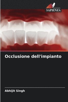 Abhijit Singh - Occlusione dell'impianto, Häftad. Tillgänglighet: Lägg i varukorg