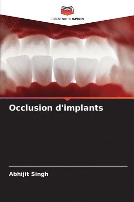 Abhijit Singh - Occlusion d'implants, Häftad. Tillgänglighet: Lägg i varukorg