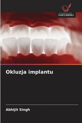 Abhijit Singh - Okluzja implantu, Häftad. Tillgänglighet: Lägg i varukorg