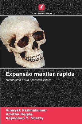 Vinayak Padmakumar, Amitha Hegde, Rajmohan Y Shetty - Expansão maxilar rápida, Häftad. Tillgänglighet: Lägg i varukorg