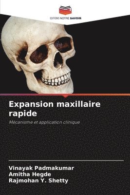 Vinayak Padmakumar, Amitha Hegde, Rajmohan Y Shetty - Expansion maxillaire rapide, Häftad. Tillgänglighet: Lägg i varukorg