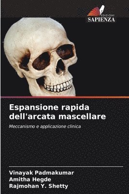 Vinayak Padmakumar, Amitha Hegde, Rajmohan Y Shetty - Espansione rapida dell'arcata mascellare, Häftad. Tillgänglighet: Lägg i varukorg