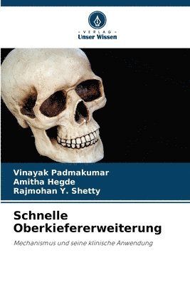 Vinayak Padmakumar, Amitha Hegde, Rajmohan Y Shetty - Schnelle Oberkiefererweiterung, Häftad. Tillgänglighet: Lägg i varukorg