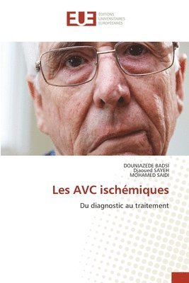 Douniazede Badsi, Djaoued Sayeh, Mohamed Saidi - Les AVC ischémiques, Häftad. Tillgänglighet: Lägg i varukorg