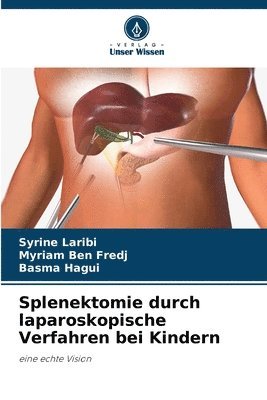 Syrine Laribi, Myriam Ben Fredj, Basma Hagui - Splenektomie durch laparoskopische Verfahren bei Kindern, Häftad. Tillgänglighet: Lägg i varukorg