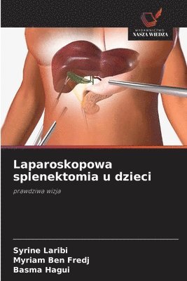 Syrine Laribi, Myriam Ben Fredj, Basma Hagui - Laparoskopowa splenektomia u dzieci, Häftad. Tillgänglighet: Lägg i varukorg