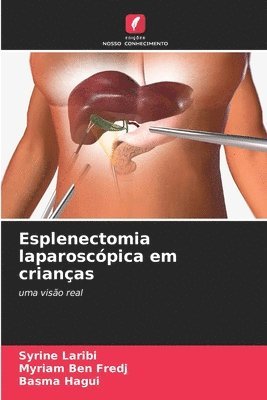 Syrine Laribi, Myriam Ben Fredj, Basma Hagui - Esplenectomia laparoscópica em crianças, Häftad. Tillgänglighet: Lägg i varukorg