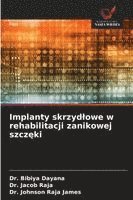 Bibiya Dayana, Jacob Raja, Johnson Raja James - Implanty skrzydlowe w rehabilitacji zanikowej szczęki, Häftad