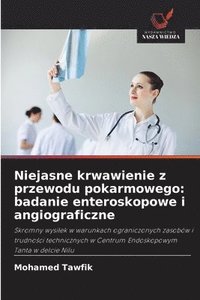 Niejasne krwawienie z przewodu pokarmowego