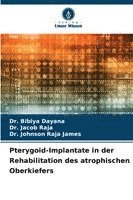 Bibiya Dayana, Jacob Raja, Johnson Raja James - Pterygoid-Implantate in der Rehabilitation des atrophischen Oberkiefers, Häftad