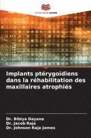 Bibiya Dayana, Jacob Raja, Johnson Raja James - Implants ptérygoïdiens dans la réhabilitation des maxillaires atrophiés, Häftad