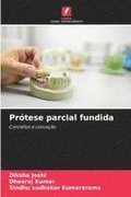 Prtese parcial fundida