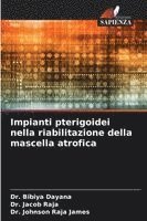 Bibiya Dayana, Jacob Raja, Johnson Raja James - Impianti pterigoidei nella riabilitazione della mascella atrofica, Häftad