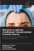 Naci?cia w g�rnej, ?rodkowej i dolnej jednej trzeciej twarzy
