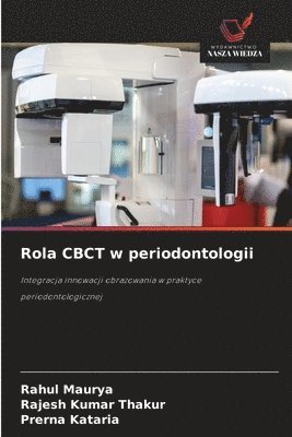Rola CBCT w periodontologii