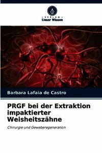 PRGF bei der Extraktion impaktierter Weisheitsz�hne