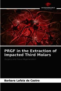 PRGF in the Extraction of Impacted Third Molars