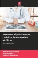 Hrashikesh Vaidya, Sumit Bedia, Mahesh Ghadage - Implantes zigomáticos na reabilitação de maxilas atróficas, Häftad. Tillgänglighet: Lägg i varukorg