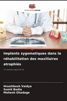 Hrashikesh Vaidya, Sumit Bedia, Mahesh Ghadage - Implants zygomatiques dans la réhabilitation des maxillaires atrophiés, Häftad. Tillgänglighet: Lägg i varukorg