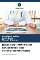 Hrashikesh Vaidya, Sumit Bedia, Mahesh Ghadage - Jochbeinimplantate bei der Rehabilitation eines atrophischen Oberkiefers, Häftad. Tillgänglighet: Lägg i varukorg