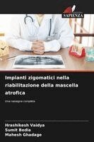 Hrashikesh Vaidya, Sumit Bedia, Mahesh Ghadage - Impianti zigomatici nella riabilitazione della mascella atrofica, Häftad. Tillgänglighet: Lägg i varukorg