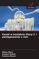 Abhay Wasu, Gautam Badole, Pratima Shenoi - Kanal w ksztalcie litery C i postępowanie z nim, Häftad. Tillgänglighet: Lägg i varukorg