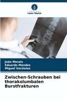 João Morais, Eduardo Mendes, Miguel Varzielas - Zwischen-Schrauben bei thorakolumbalen Burstfrakturen, Häftad