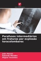 João Morais, Eduardo Mendes, Miguel Varzielas - Parafusos intermediários em fraturas por explosão toracolombares, Häftad