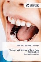 Paridhi Singh, Rishi Manan, Saumya Vats - Art and Science of Cast Metal Restorations, Häftad
