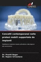 Praniti Nagar, Rajeev Srivastava - Concetti contemporanei nelle protesi mobili supportate da impianti, Häftad