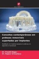 Praniti Nagar, Rajeev Srivastava - Conceitos contemporâneos em próteses removíveis suportadas por implantes, Häftad