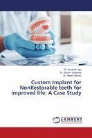 Santosh Jaju, Sachin Untawale, Nilesh Nirwan - Custom Implant for NonRestorable teeth for improved life, Häftad. Tillgänglighet: Lägg i varukorg