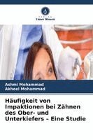 Ashmi Mohammad, Akheel Mohammad - Häufigkeit von Impaktionen bei Zähnen des Ober- und Unterkiefers - Eine Studie, Häftad. Tillgänglighet: Lägg i varukorg