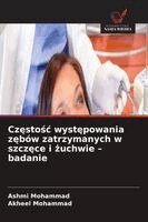Ashmi Mohammad, Akheel Mohammad - Częstośc występowania zębów zatrzymanych w szczęce i żuchwie - badanie, Häftad. Tillgänglighet: Lägg i varukorg
