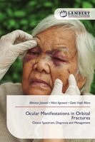 Abhinav Jaiswal, Nikit Agrawal, Geeti Vajdi Mitra - Ocular Manifestations in Orbital Fractures, Häftad