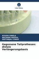 Ayushi Singla, Archana Nagpal, Geetanjali Singh - Gegossene Teilprothesen, Häftad