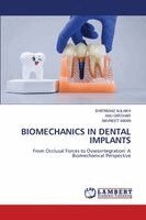 Biomechanics in Dental Implants
