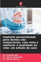 Santosh Jaju, Sachin Untawale, Nilesh Nirwan - Implante personalizado para dentes não restauráveis, com vista a melhorar a qualidade de vida, Häftad. Tillgänglighet: Lägg i varukorg